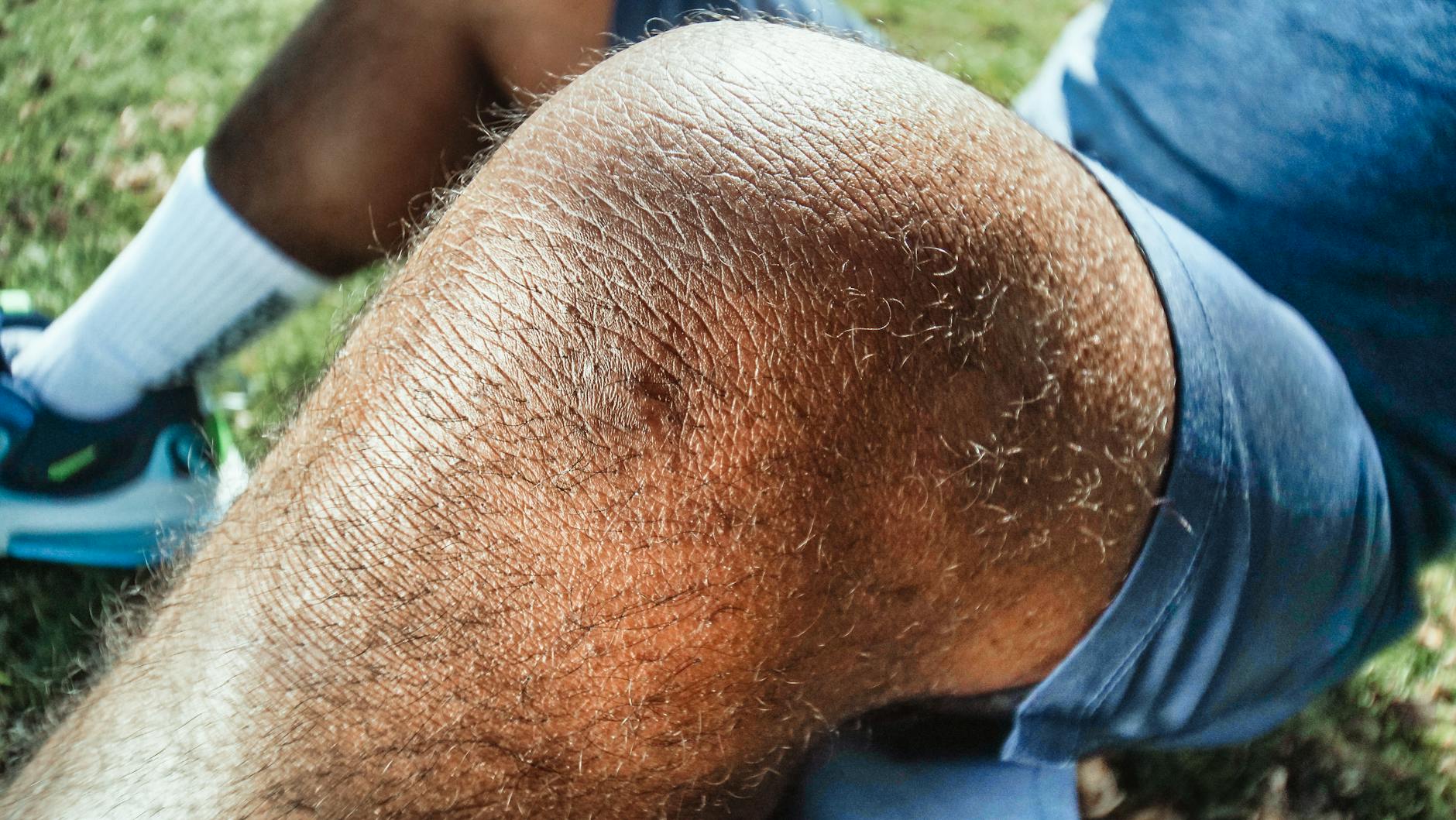 Runner gripping painful knee on trail, grimacing mid-stride